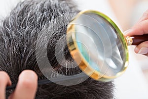 Dermatologist Checking Patient`s Hair