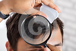 Dermatologist Checking Patient`s Hair With Magnifying Glass