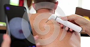 Dermatologist doctor examines birthmarks and birthmarks of patient using dermatoscope and smartphone