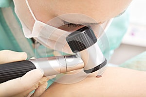 Dermatologist examines birthmark with dermatoscope