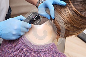 dermatologist examines a mole on the patient& x27;s neck using a special device - a dermatoscope. Prevention of skin
