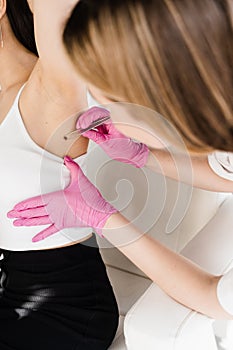 Dermatologist examines moles or birthmark of girl patient for revention of melanoma and skin cancer. Checking for benign