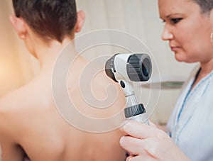 Dermatologist examines patient birthmark with dermatoscope. Medical equipment