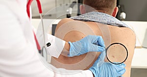 Dermatologist examines patient birthmark with magnifying glass in clinic 4k movie