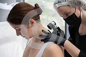 A dermatologist examines a patient& x27;s mole through a dermatoscope.
