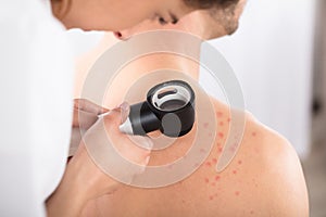 Dermatologist Examining Acnes Of Patient