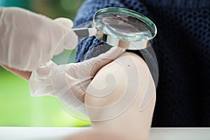 Dermatologist examining a mole