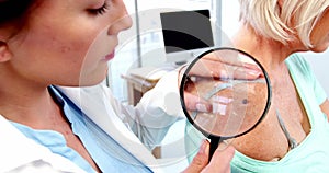 Dermatologist examining mole with magnifying glass