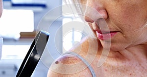 Dermatologist examining mole with magnifying glass