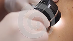 Dermatologist examining mole with magnifying glass in clinic