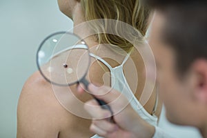 Dermatologist examining mole with magnifying glass