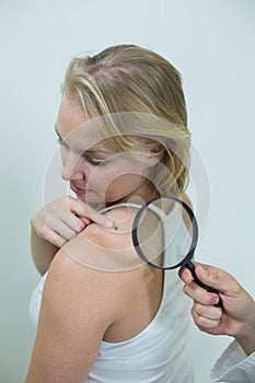 Dermatologist examining mole with magnifying glass