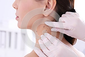 Dermatologist examining patient in clinic, closeup