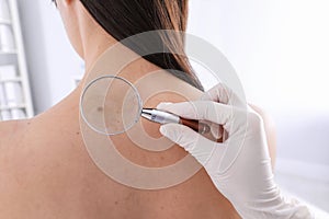 Dermatologist examining patient with magnifying glass in clinic