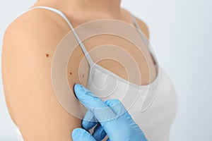 Dermatologist examining patient's birthmark on beige background, closeup