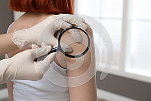 Dermatologist examining patient`s birthmark with magnifying glass in clinic, closeup view