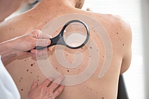 Dermatologist examining the skin of a patient