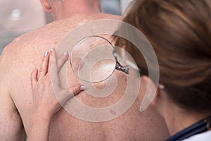 Dermatologist examining the skin of a patient