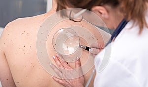 Dermatologist examining the skin of a patient