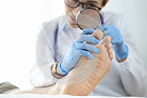 Dermatologist examining toenail with magnifying glass closeup