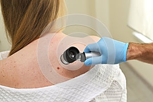 dermatologist oncologist uses a dermatoscope to examine moles and birthmarks on the patient& x27;s body. Melanoma Day