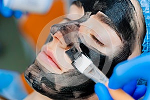 Dermatologist smears black mask on face for laser photorejuvenation and carbon peeling. Dermatology and cosmetology