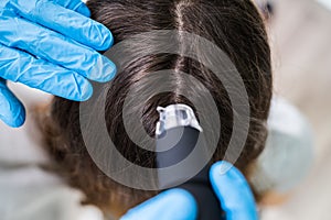 Dermatologist Using Trichoscope For Hair Fall Treatment