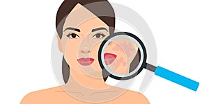 Dermatology magnifying glass woman face skin problem skincare vector