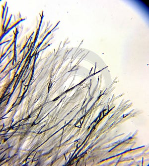 Dermatophyte fungual mycelium under the microscope