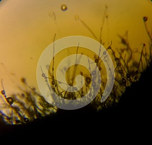 Dermatophyte fungual mycelium under the microscope