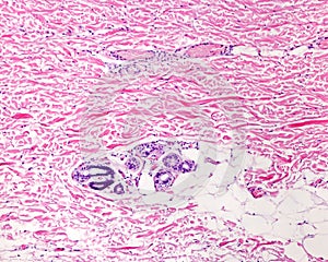 Dermis of thin skin. Hematoxylin-eosin photo