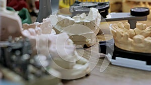 Desk prosthetist, a lot of models of dental jaw prostheses