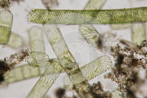 Destroyed structures of filamentous freshwater algae Spirogyra