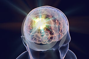 Destruction of brain tumor