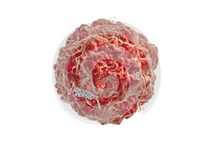Destruction of cancer cell