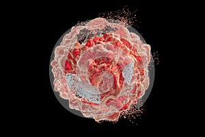 Destruction of cancer cell