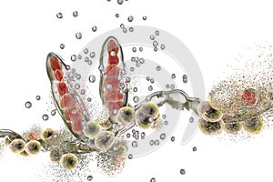 Destruction of fungus Trichophyton by silver nanoparticles