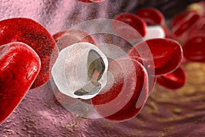 Destruction of red blood cells photo