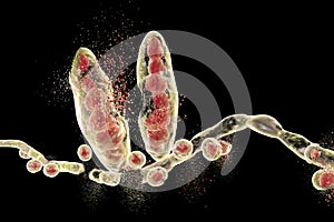 Destruction of Trichophyton fungus