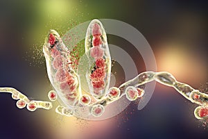 Destruction of Trichophyton fungus