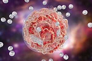 Destruction of a tumor cell by nanoparticles