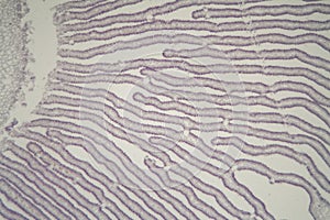 Coprinus mushroom under the microscope