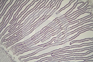 Coprinus mushroom under the microscope