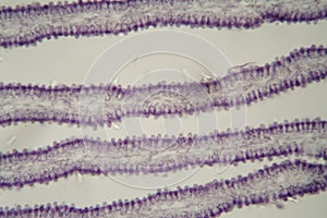 Coprinus mushroom under the microscope