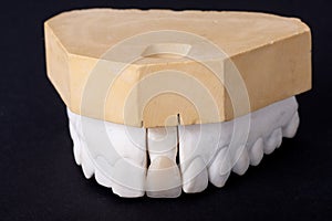 Detail dental wax model