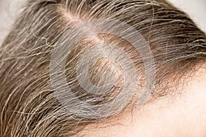 Detail of gray hair of a woman