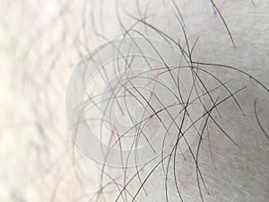 Detail of human skin with hair, close-up, macro.