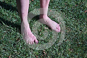 Detail of mature adult man`s bare feet on a park lawn to alleviate his blood circulation problems