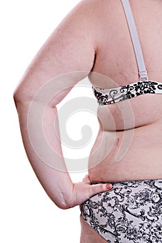 Detail of the side torso girl with obesity
