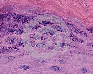Epidermis. Granular layer photo